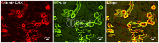 KCNJ10 (Kir4.1 or SeSAME) Antibody - Western Blot Validated