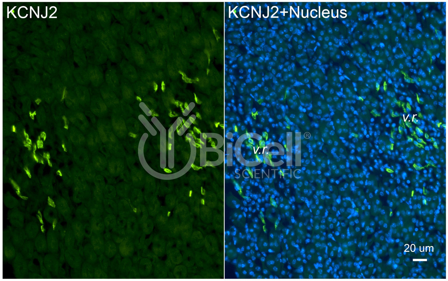 KCNJ2 (Kir2.1) Antibody - Western Blot Validated