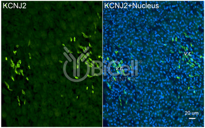 KCNJ2 (Kir2.1) Antibody - Western Blot Validated