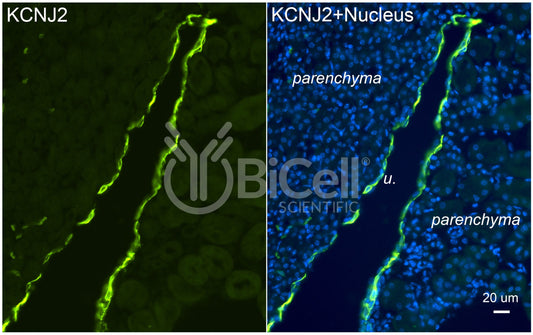KCNJ2 (Kir2.1) Antibody - Western Blot Validated