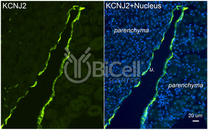 KCNJ2 (Kir2.1) Antibody - FFPE Validated