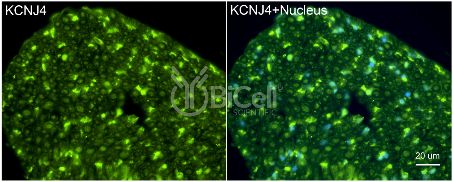 KCNJ4 (Kir2.3) Antibody