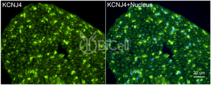 KCNJ4 (Kir2.3) Antibody