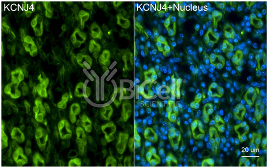KCNJ4 (Kir2.3) Antibody - Western Blot Validated
