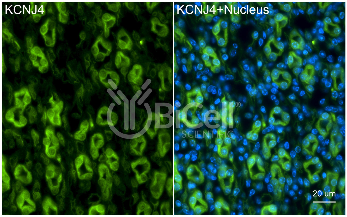 KCNJ4 (Kir2.3) Antibody