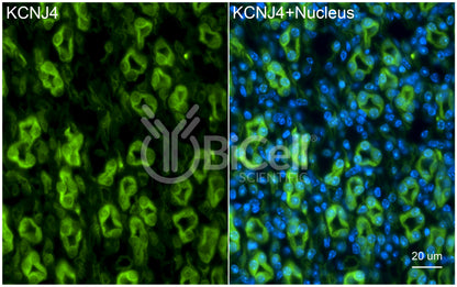 KCNJ4 (Kir2.3) Antibody