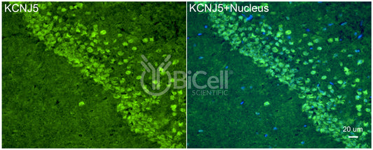 KCNJ5 (Kir3.4 or GIRK4) Antibody - Western Blot Validated