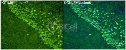 KCNJ5 (Kir3.4 or GIRK4) Antibody