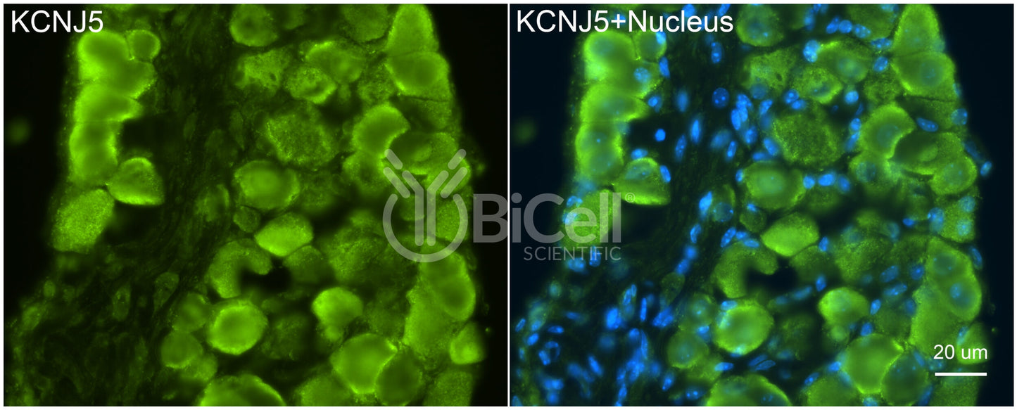 KCNJ5 (Kir3.4 or GIRK4) Antibody - FFPE Validated