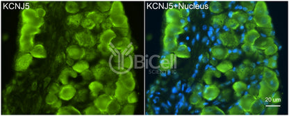 KCNJ5 (Kir3.4 or GIRK4) Antibody - FFPE Validated