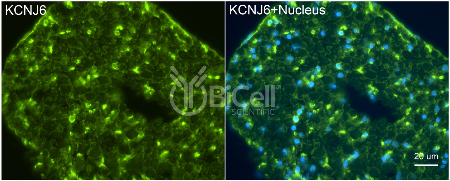 KCNJ6 (Kir3.2 or GIRK2) Antibody - Western Blot Validated