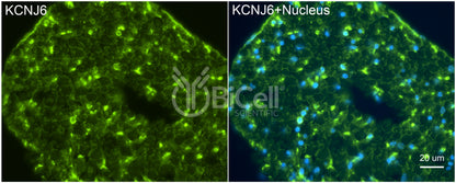 KCNJ6 (Kir3.2 or GIRK2) Antibody - Western Blot Validated