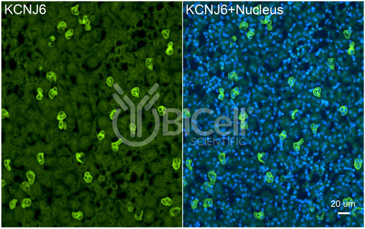 KCNJ6 (Kir3.2 or GIRK2) Antibody - FFPE Validated