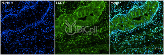 KDM1A (LSD1) Antibody - Western Blot Validated