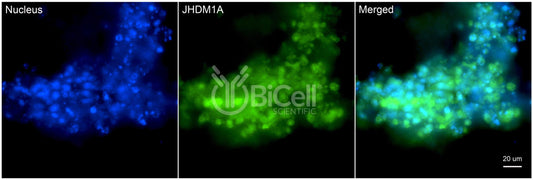 KDM2A (JHDM1A) Antibody