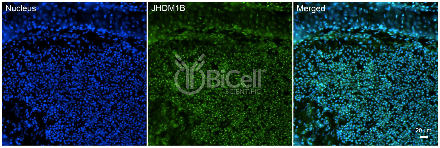 KDM2B (JHDM1B) Antibody
