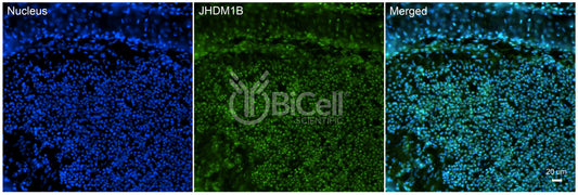 KDM2B (JHDM1B) Antibody