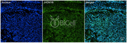 KDM2B (JHDM1B) Antibody - FFPE Validated
