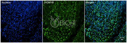 KDM2B (JHDM1B) Antibody - Western Blot Validated
