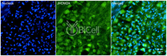 KDM3A (JHDM2A) Antibody - Western Blot Validated