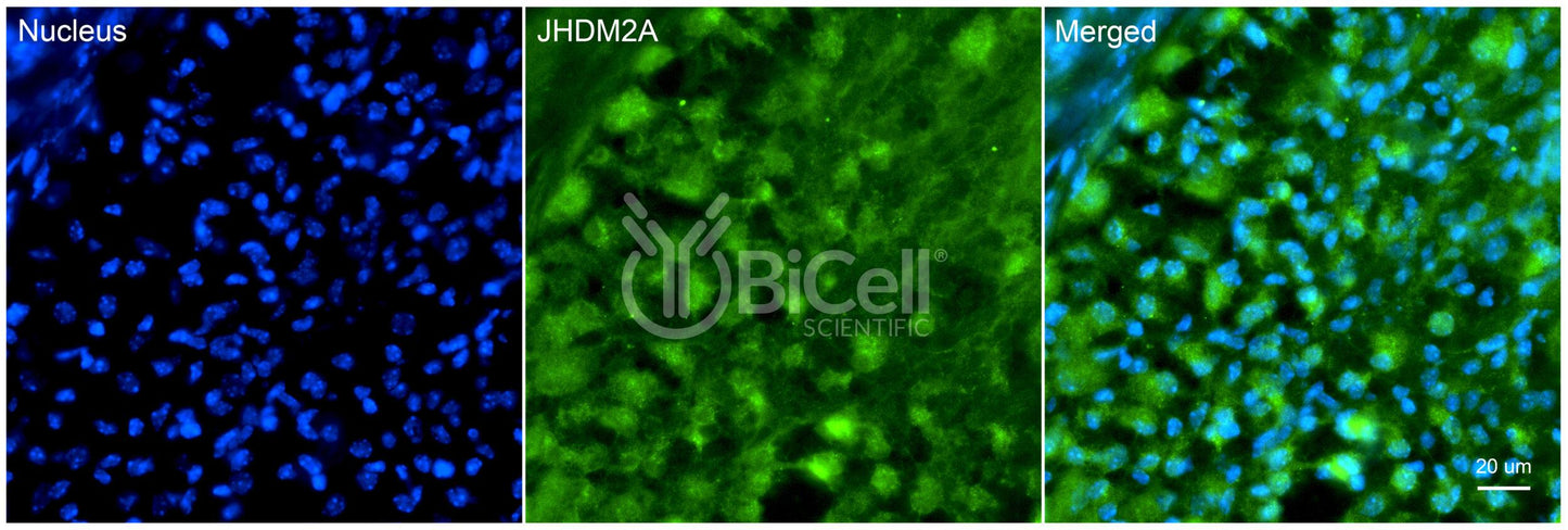 KDM3A (JHDM2A) Antibody - FFPE Validated