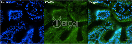 KDM3B Antibody - FFPE Validated