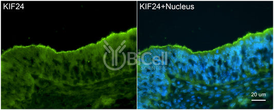 KIF24 (C-Terminus) Antibody - Western Blot Validated