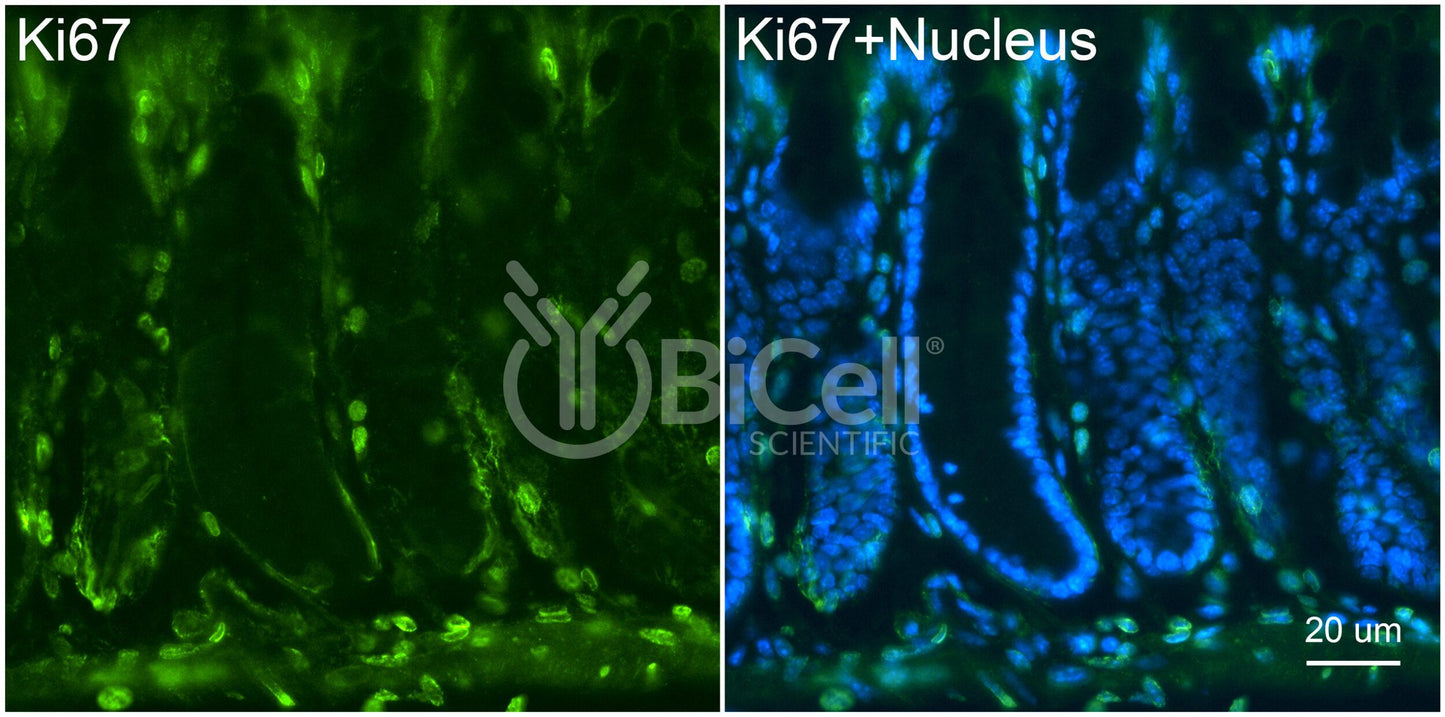 Ki67 (C-Terminus) Antibody - FFPE Validated