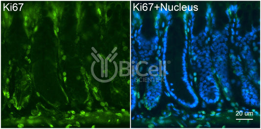Ki67 (C-Terminus) Antibody - FFPE Validated
