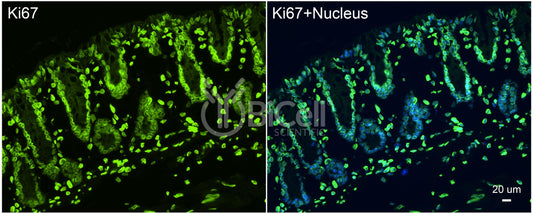 Ki67 (N-Terminus) Antibody - FFPE Validated
