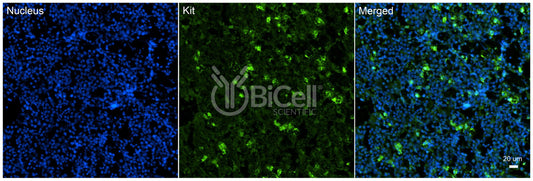 KIT (c-Kit or SCFR or CD117) Antibody - Western Blot Validated