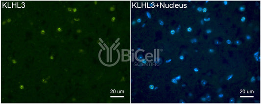 KLHL3 Antibody - Western Blot Validated