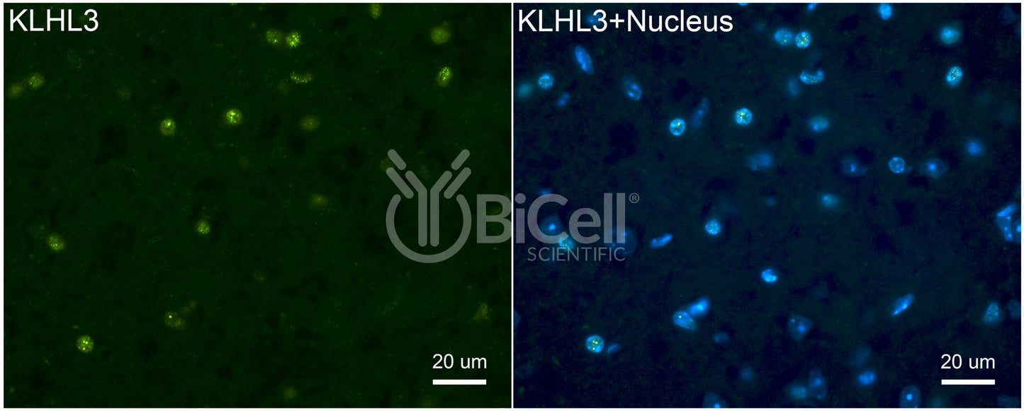 KLHL3 Antibody