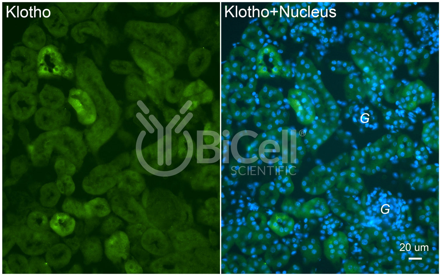 Klotho (KL) Antibody - Western Blot Validated