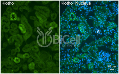Klotho (KL) Antibody - Western Blot Validated
