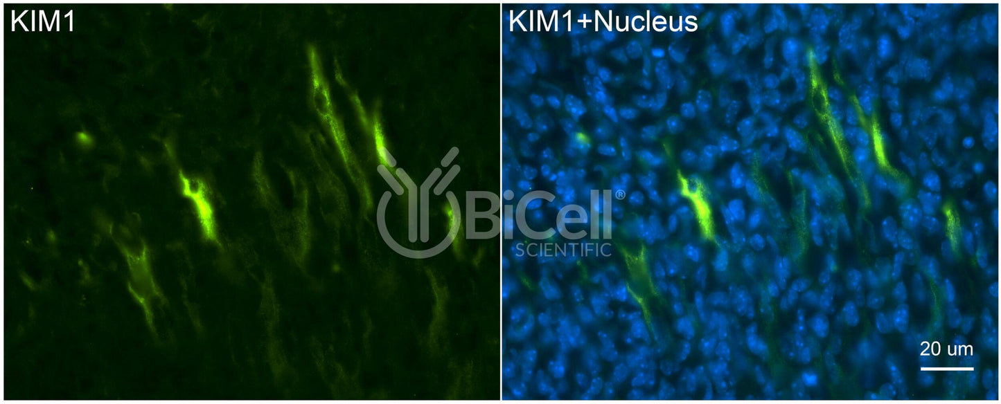 KIM1 (TIM1 or HAVCR1) Antibody - Western Blot Validated