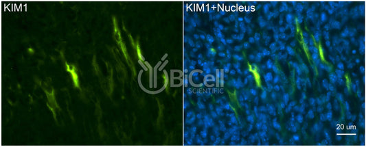 KIM1 (TIM1 or HAVCR1) Antibody - FFPE Validated