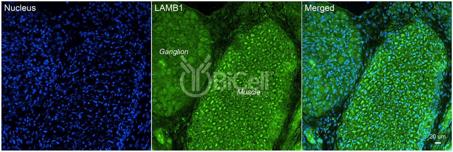 Laminin beta-1 (LAMB1) HiRe Antibody - FFPE Validated