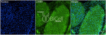 Laminin beta-1 (LAMB1) HiRe Antibody - FFPE Validated