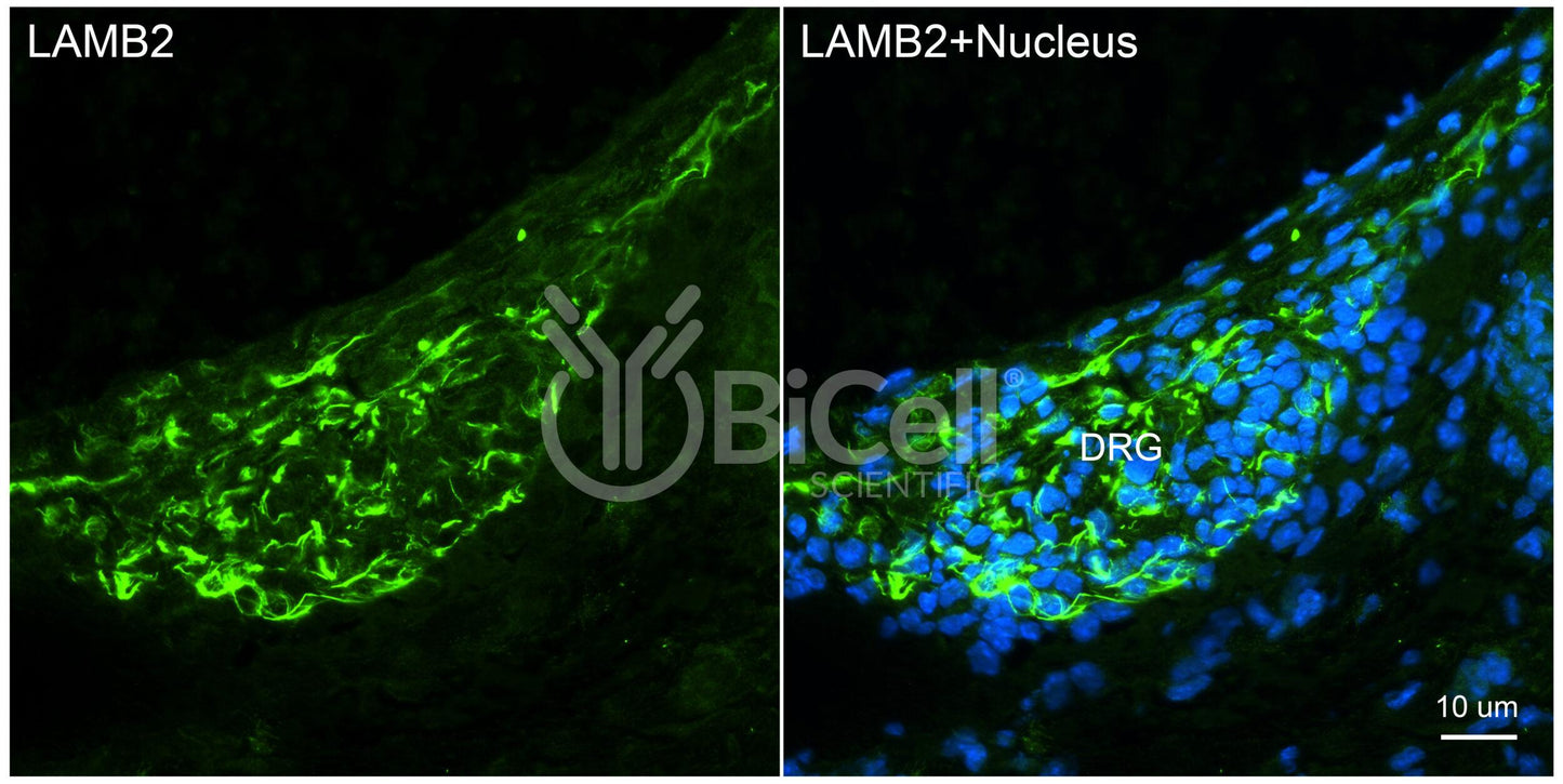 Laminin beta-2 (LAMB2) HiRe Antibody - Western Blot Validated