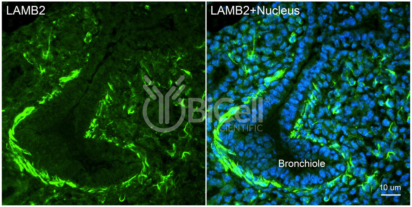 Laminin beta-2 (LAMB2) HiRe Antibody