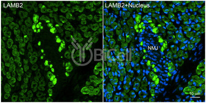 Laminin beta-2 (LAMB2) HiRe Antibody - Western Blot Validated