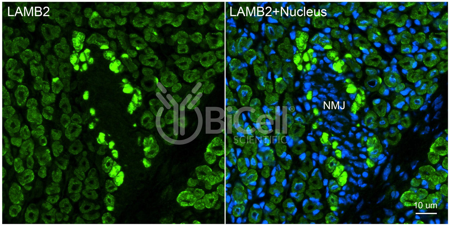 Laminin beta-2 (LAMB2) HiRe Antibody - FFPE Validated