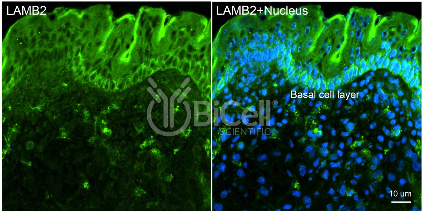 Laminin beta-2 (LAMB2) HiRe Antibody - Western Blot Validated
