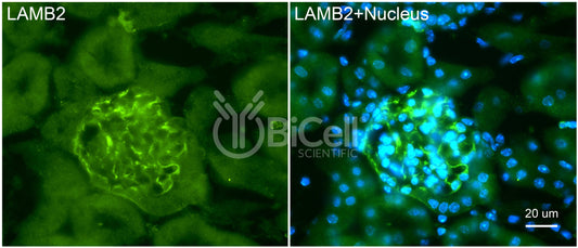 Laminin beta-2 (LAMB2) HiRe Antibody