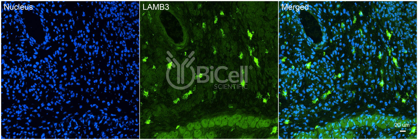 Laminin beta-3 (LAMB3) HiRe Antibody