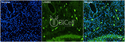 Laminin beta-3 (LAMB3) HiRe Antibody