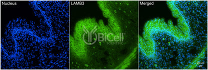 Laminin beta-3 (LAMB3) HiRe Antibody - FFPE Validated