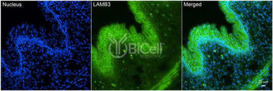 Laminin beta-3 (LAMB3) HiRe Antibody - FFPE Validated