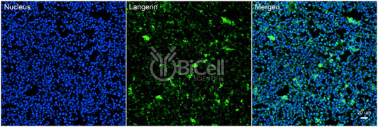 Langerin (CLEC4K or CD207) Antibody - Western Blot Validated